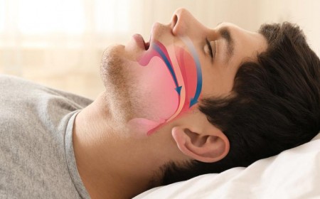 NÃO BỘ CÓ THỂ BỊ TỔN THƯƠNG BỞI TRIỆU CHỨNG NGƯNG THỞ KHI NGỦ