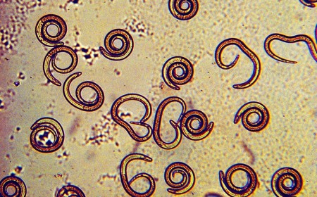 Bệnh giun xoắn Trichinella: Nguyên nhân lây truyền và cách điều trị hiệu quả
