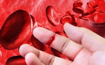 Bệnh Máu Khó Đông, Chẩn Đoán Và Hướng Điều Trị Bệnh Máu Khó Đông