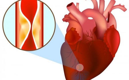 NGƯỜI TRẺ BỊ NHỒI MÁU CƠ TIM