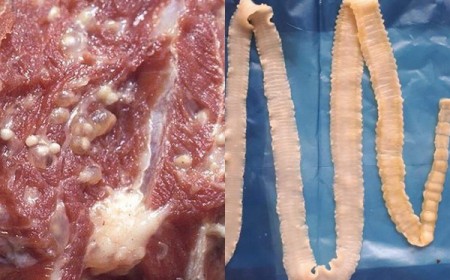 Bệnh Sán Lợn Gạo Taenia Solium: Nguyên Nhân, Triệu Chứng, Phòng Tránh Và Điều Trị Hiệu Quả