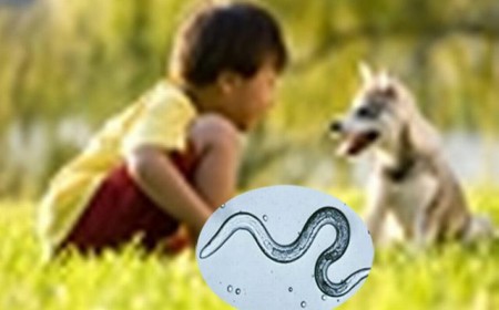 Cách nhận biết trẻ bị nhiễm giun sán dành cho ba mẹ
