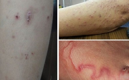 Trung Tâm Xét Nghiệm Và Điều Trị Bệnh Giun Sán