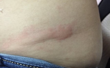 Chi Phí Xét Nghiệm Giun Đũa Chó Và Ký Sinh Trùng Hết Bao Nhiêu Tiền?