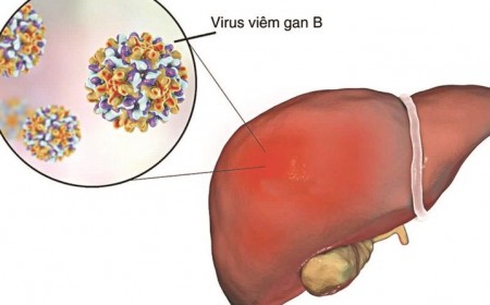 Có Uống Thuốc Trị Sán Chó Toxocara Khi Đang Điều Trị Viêm Gan B Và Tiểu Đường Type 2 Được Không?