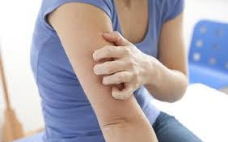 Tư vấn thuốc trị sán chó đúng cách