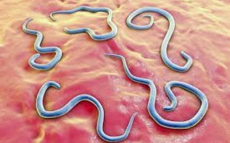 Chẩn đoán và điều trị bệnh giun đũa