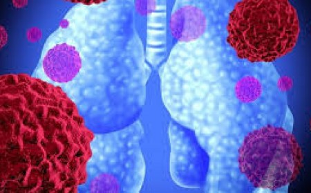 Những Điều Cần Biết Về Bệnh Nấm Aspergillus