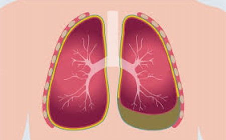 Triệu Chứng Của Bệnh Sán Lá Phổi