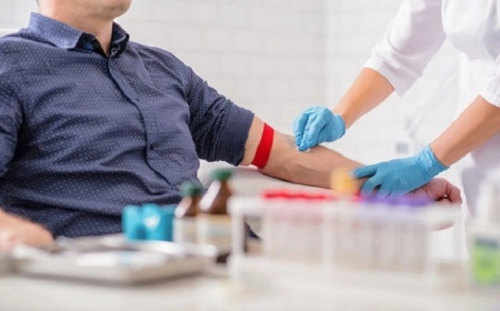 Nam Giới Sau 40 Tuổi Cần Xét Nghiệm Kiểm Tra Sức Khỏe Tổng Quát Những Gì? Lưu Ý Trong Ăn Uống Và Sin