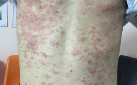 Một Số Nguyên Nhân Ngứa Da Không Nên Xem Thường