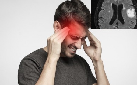 Nhiễm Ấu Trùng Sán Dải Lợn: Nguyên Nhân Và Cách Điều Trị