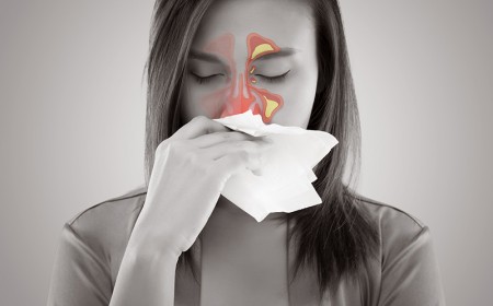 Những Điều Bệnh Nhân Cần Biết Về Viêm Xoang và Nhiễm Trùng Xoang