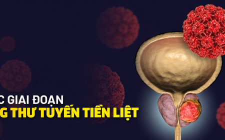 Tại Sao Cần Tầm Soát Ung Thư Tuyến Tiền Liệt Sớm Ở Nam Giới!