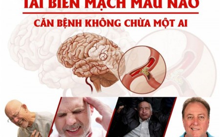 2 NGUYÊN NHÂN GÂY TAI BIẾN MẠCH MÁU NÃO