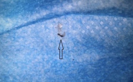 Trị Bệnh Sán Chó Có Khỏi Bệnh Ngứa Da Không?