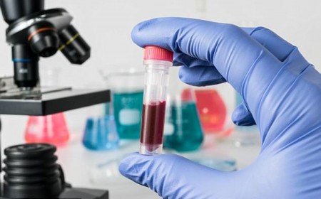 Xét Nghiệm Ký Sinh Trùng Giun Sán Như Thế Nào? Có Cần Nhịn Ăn Không?