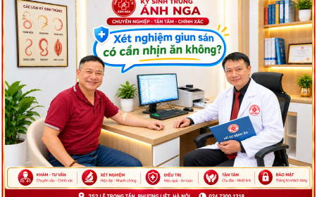 Xét Nghiệm Giun Sán Có Cần Nhịn Ăn Không? Bác Sĩ Tư Vấn