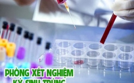 XÉT NGHIỆM KÝ SINH TRÙNG GIUN SÁN CÓ CẦN NHỊN ĂN KHÔNG?