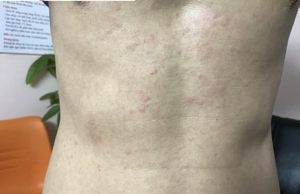 TRIỆU CHỨNG GIUN SÁN CHÓ MÈO