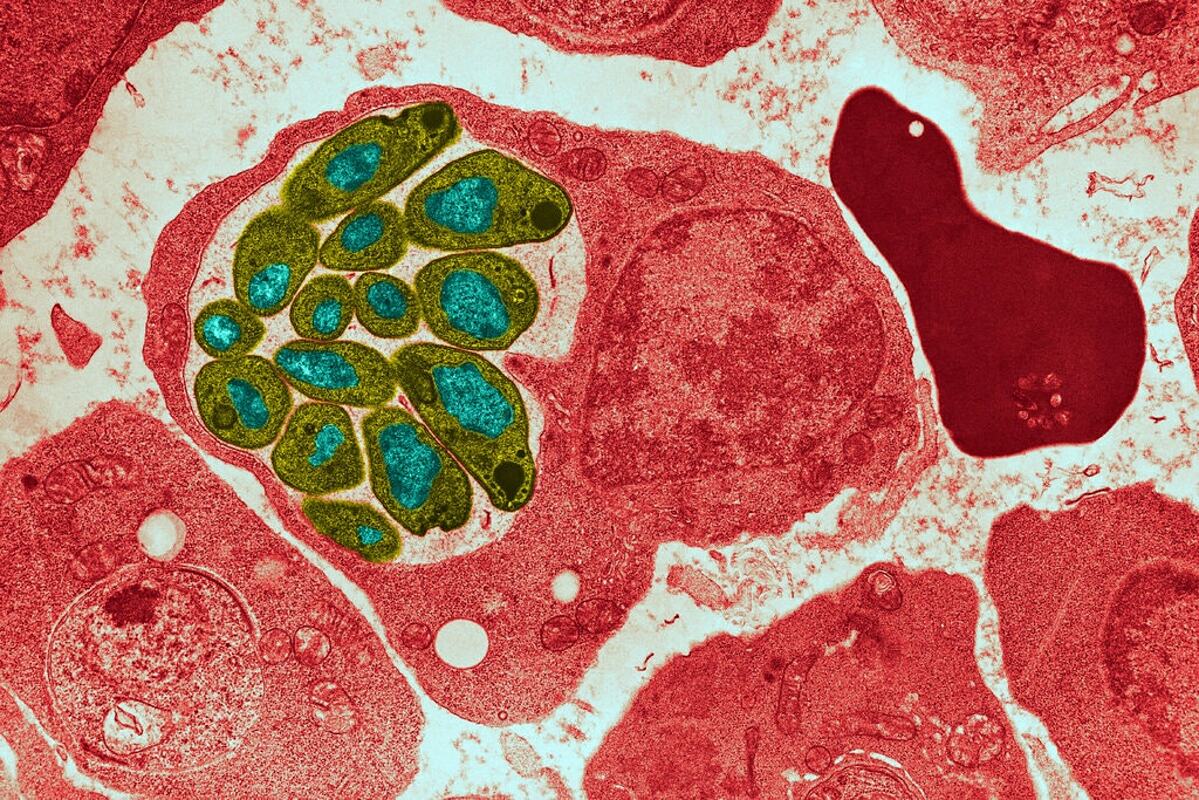 Hình ảnh hiển vi cho thấy ký sinh trùng sốt rét lây lan sang tế bào hồng cầu. Ảnh: Science