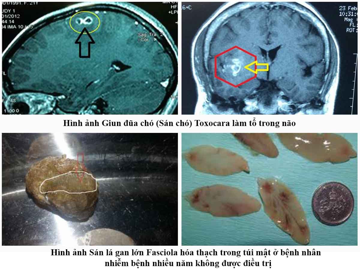 Khi Trẻ Bị Dị Ứng Da Cần Làm Xét Nghiệm Gì Tìm Nguyên Nhân