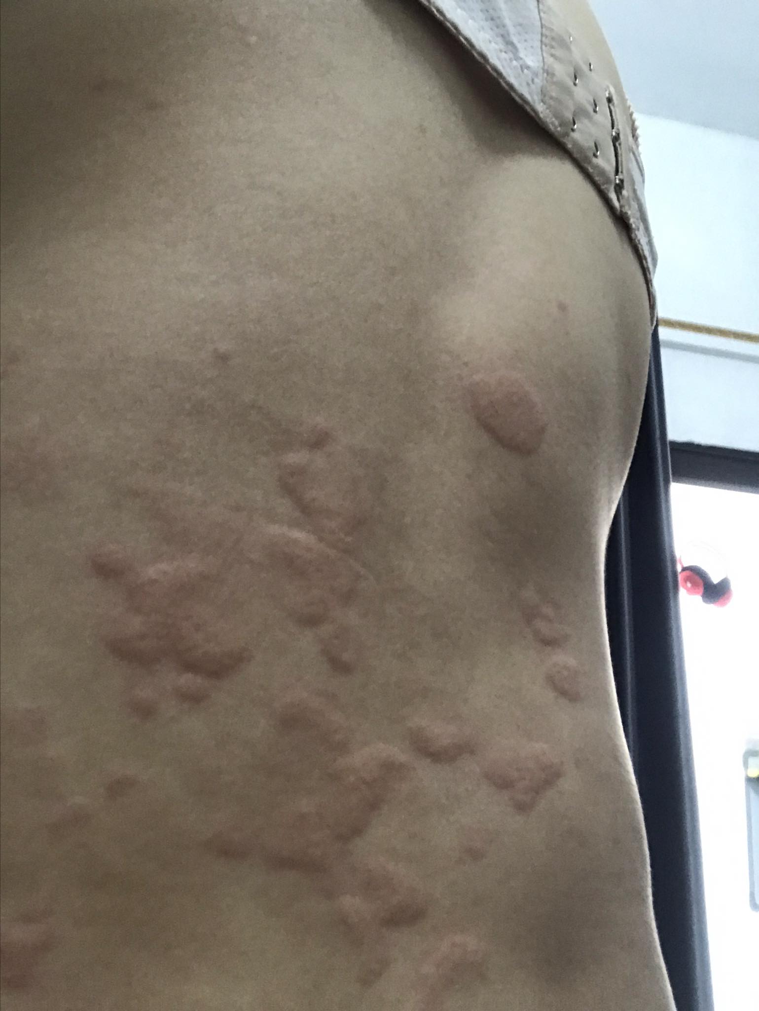 Bệnh Giun Sán Chó Mèo Toxocara Lây Truyền Thế Nào? Có Chữa Khỏi Hoàn ...