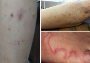 Trung Tâm Xét Nghiệm Và Điều Trị Bệnh Giun Sán