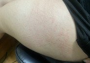 Con Mạt Bụi Nhà Là Gì? Nguyên Nhân Gây Dị Ứng, Cách Phòng Ngừa Và Xử Trí Hiệu Quả Con Mạt Bụi Nhà