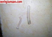 Đi Cầu Ra Giun Có Nguy Hiểm Không Khám Chữa Trị Ở Đâu?