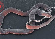Dương Tính Với Echinococcus Có Nguy Hiểm Không, Điều Trị Thế Nào?