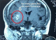 Dương Tính Với Sán Chó Toxocara Có Phải Đã Lên Não?