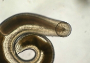 Giun Đầu Gai Gnathostoma: Nguyên Nhân, Triệu Chứng Và Điều Trị