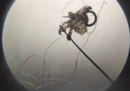 Rận Mu: Nguyên Nhân, Triệu Chứng, Phòng Ngừa Và Cách Điều Trị Hiệu Quả