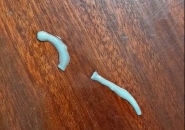 Cách Phòng Tránh Sán Dây Bò Và Những Món Ăn Dễ Nhiễm